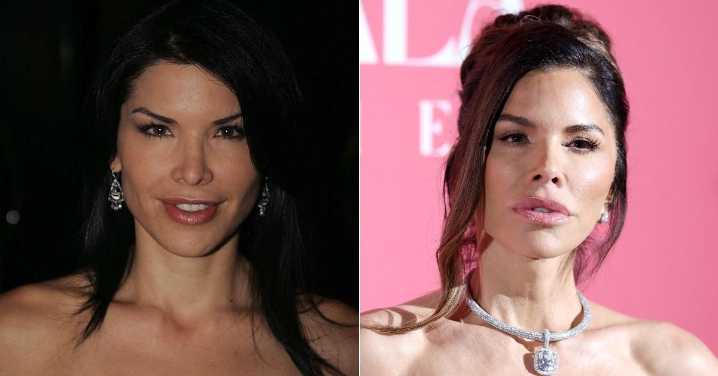EXCLUSIVE: Lauren Sánchez Sparks Yet More 'Wedding Facelift' Rumors