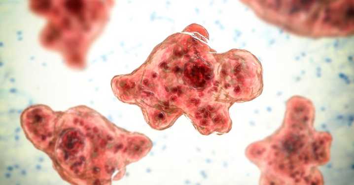 Texas woman dies from brain-eating amoeba after using tap water for sinus rinse