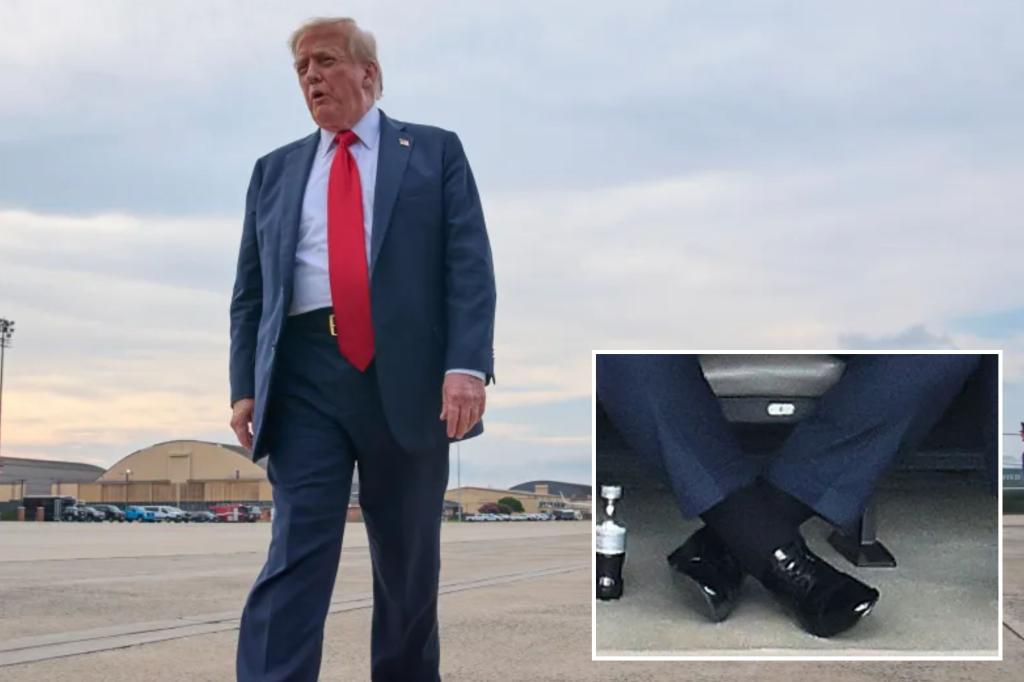 Trump suffering from chronic venous insufficiency after leg swelling: WH