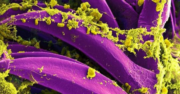 Person dies from bubonic plague in northern Arizona