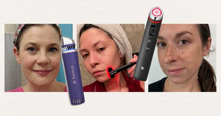 The 8 Best Skincare Wands of 2025 with Original Photos