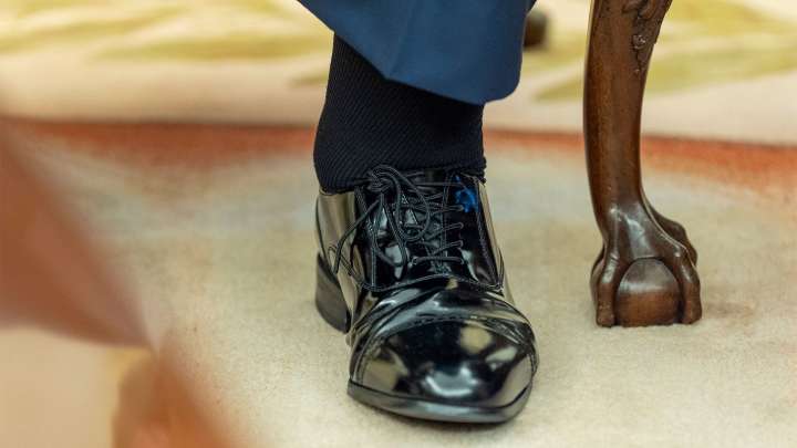 What is chronic venous insufficiency? Trump diagnosis puts the condition in the spotlight