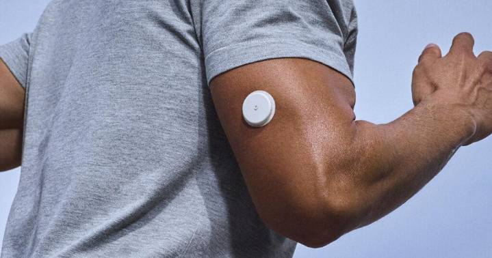 Monitores glucosa continuos populares, pero expertos cuestionan su necesidad