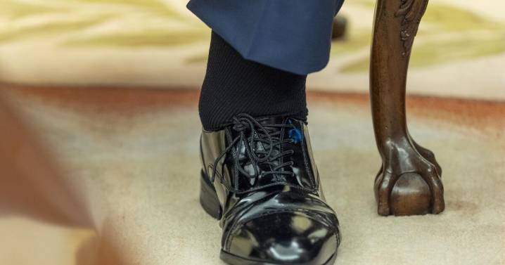 What to know about chronic venous insufficiency — President Tump's health diagnosis