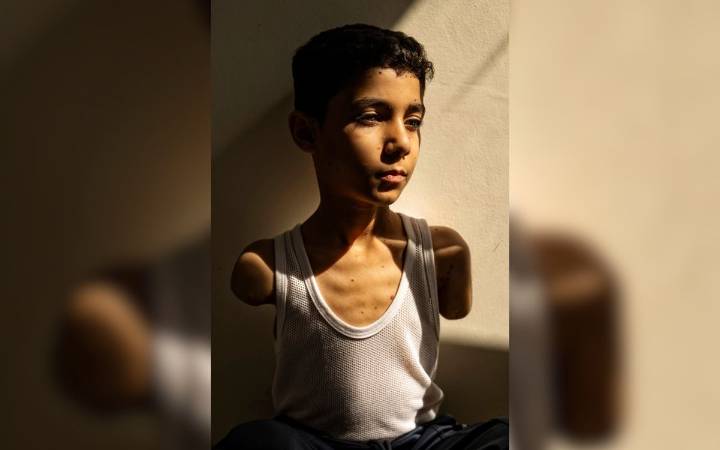 World Press Photo 2025: Secuelas en niños gazatíes, migración y sequías