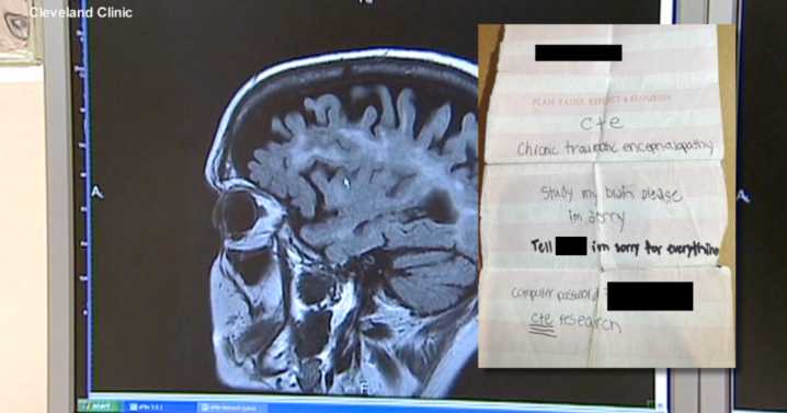 Note found on NYC shooter raises questions about CTE brain disease