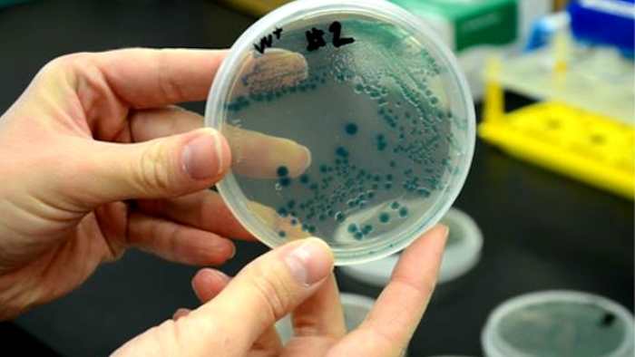 Una bacteria carnívora mata a 1 persona en el sur de la Florida en 2025