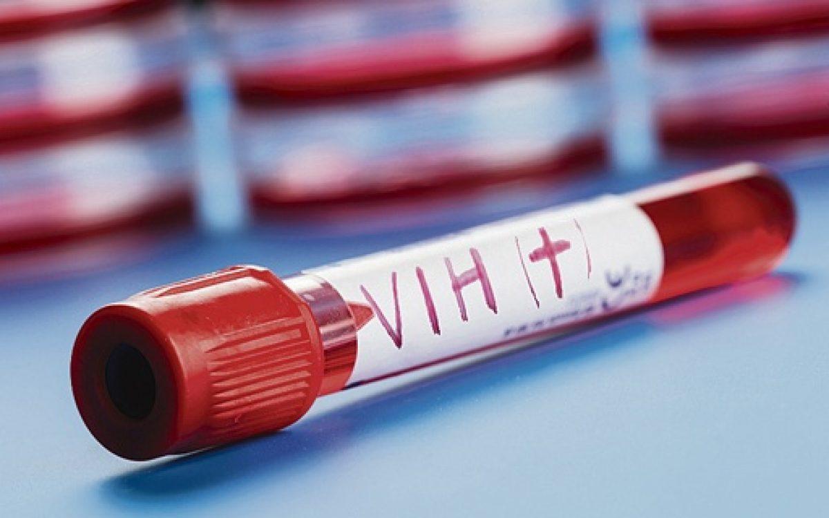 Un estudio preclínico muestra que una sola inyección al nacer protege del VIH durante años