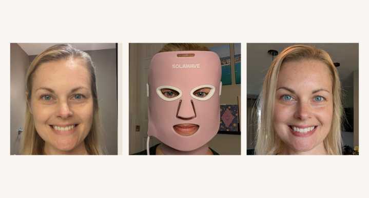 Solawave's Wrinkle Retreat Mask, Reviewed (with Photos)
