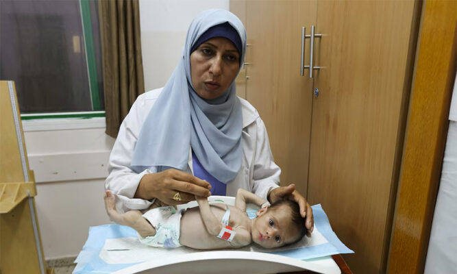 Demasiado débiles para llorar: así sobreviven los bebés desnutridos en el hospital Nasser de Gaza