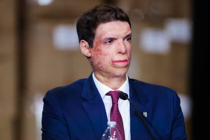 US Senate confirms Sam Brown to Department of Veterans Affairs position 