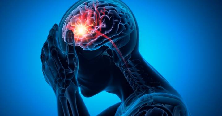 Time is critical when treating a stroke, Atlanta doctors say