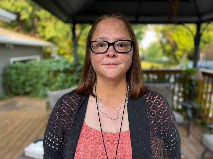 Why are so many federal inmates dying shortly before their release date?