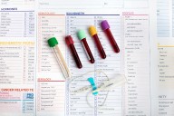 What do your blood test results mean? A toxicologist explains the basics of how to interpret them