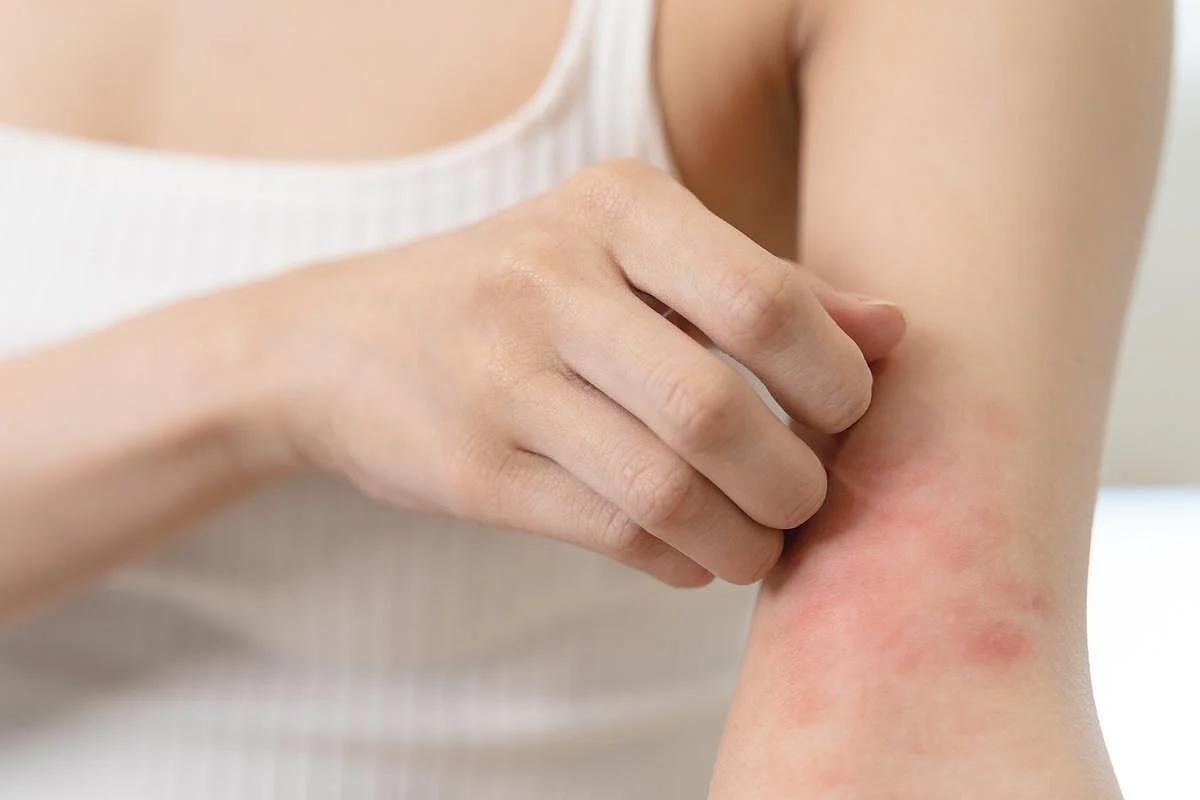 Doctors Seek Best Way to Treat Newly Discovered Genetic Disorder