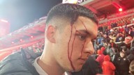 Independiente vs. U de Chile: suspendido tras enfrentamientos y heridos El Rojo y la U empataban 1 a 1 por el partido de vuelta de los octavos de final de la Copa Sudamericana en un duelo que no termi