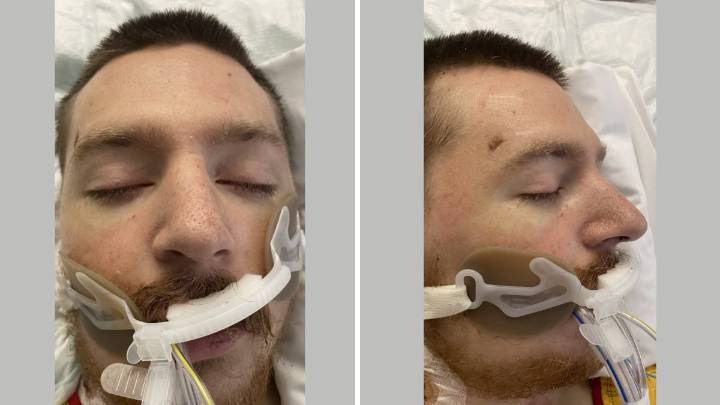 Buscan identificar hombre recluido en Temple University Hospital 