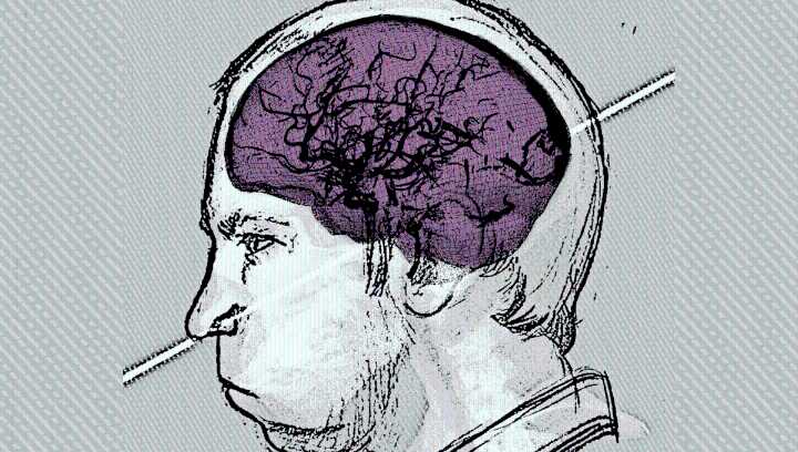 Physicist Anatoli Bugorski Survived A Proton Beam Through The Head