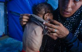 Los muertos por desnutrición en Gaza superan ya los 250, incluidos 11 este viernes