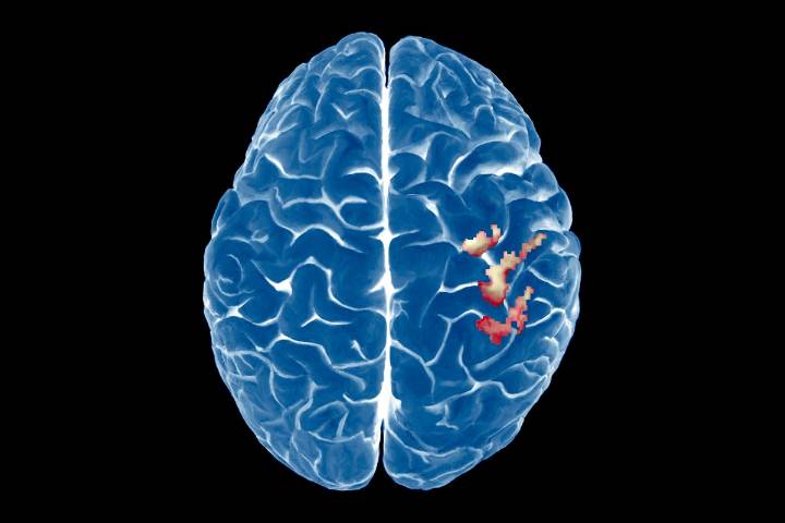 The Brain’s Map of the Body Is Surprisingly Stable