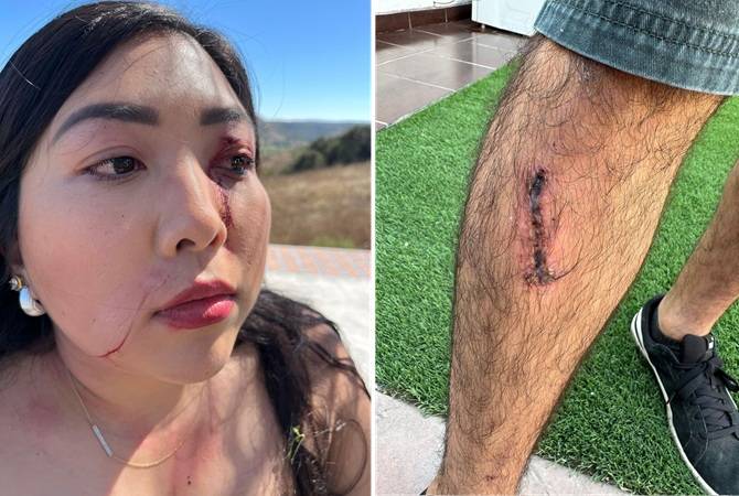 Heridos por caída de muelle acusan evasión de responsabilidad de restaurante en Valle de Guadalupe