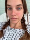 Barbara Palvin Details Long Recovery After Endometriosis Diagnosis, Surgery