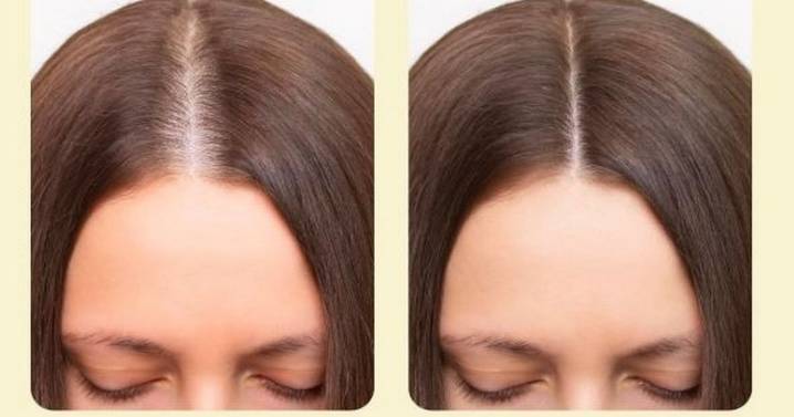 Amazon reduces £18 'amazing' growth serum that 'makes hair feel thicker and stronger'