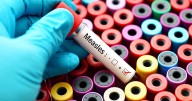 No Idaho cases reported after measles detected in Cd'A wastewater