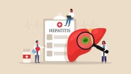 La hepatitis autoinmune más allá del tratamiento estándar