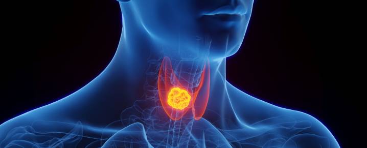 Concerns Emerge Over Potential Cancer Links to Drugs Like Ozempic