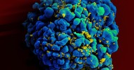 Whatever happened to ... the race to cure HIV? There's promising news
