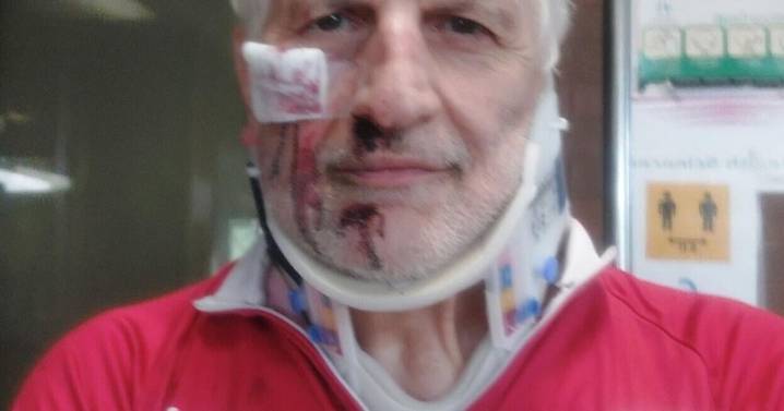 Cyclist attacked by naked bike thief grateful for Hamilton’s ‘true spirit’