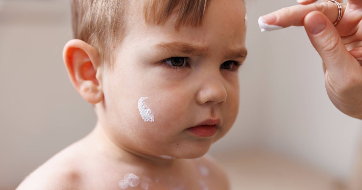 Free chickenpox vaccine for all children on NHS - when GPs can give it to save you £150