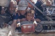 Once nuevos muertos en Gaza por desnutrición elevan a 300 el...