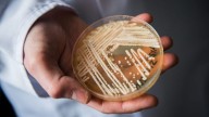 Candida auris cases nearly triple as deadly fungus spreads to new states