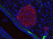 A New Chapter For Diabetes—and Regenerative Medicine