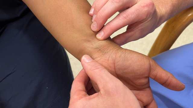 Doctor uses minimally invasive procedure for women with fibroids