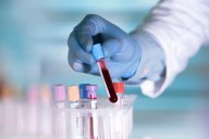 Scientists Say This $2 Test Detects COVID and Lyme Disease in Just 15 Minutes