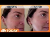 Dermatologist Shares Benefits of Peptides for Skincare Routine