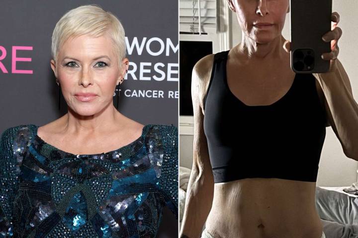 Nicole Eggert Has Mastectomy, Breast Reconstruction