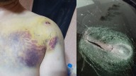 Terror en la autopista Salamanca-León: Hieren a Edgar tras ataque con piedra