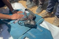 Ataque de Israel a hospital en Gaza deja 20 muertos: 5 periodistas entre las víctimas fatales