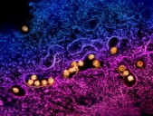 West Nile Virus Found in Eagle Point Mosquitoes Prompting Warnings Across Jackson County