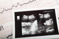 Trump administration appeals to some pro-life reproductive health care despite IVF push