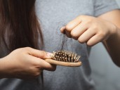 Señales de alopecia y qué puedes hacer para frenarla