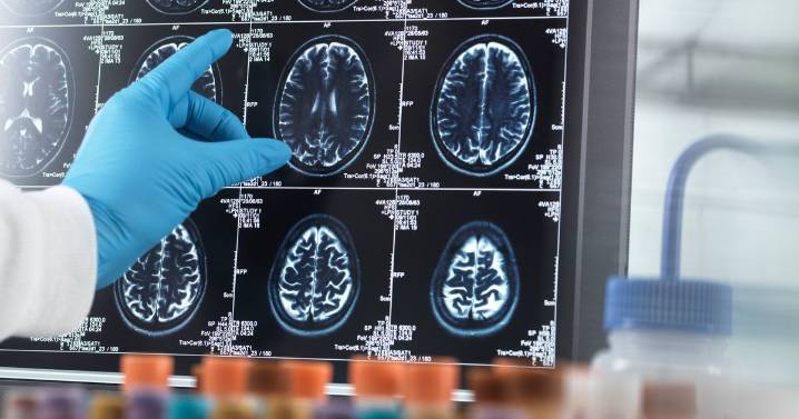 Daily morning hot drink could slash risk of brain decline