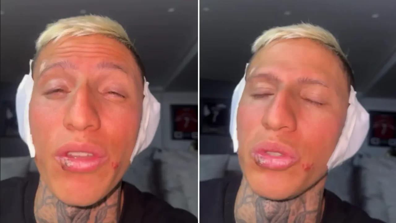 "Casi pierdo mis orejitas": La Liendra reveló que estuvo al borde de la muerte por grabar un video