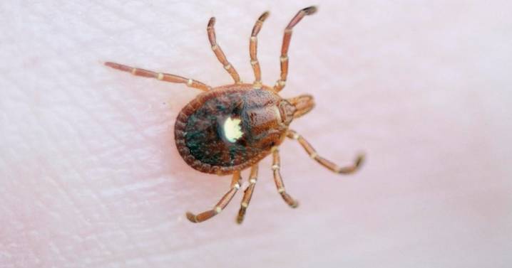 Meat, dairy allergies from tick bites "skyrocketing" on Martha's Vineyard, expert says