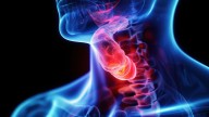 New Dual-Modality Endoscopy Method Aims to Improve Early Detection of Esophageal Cancer