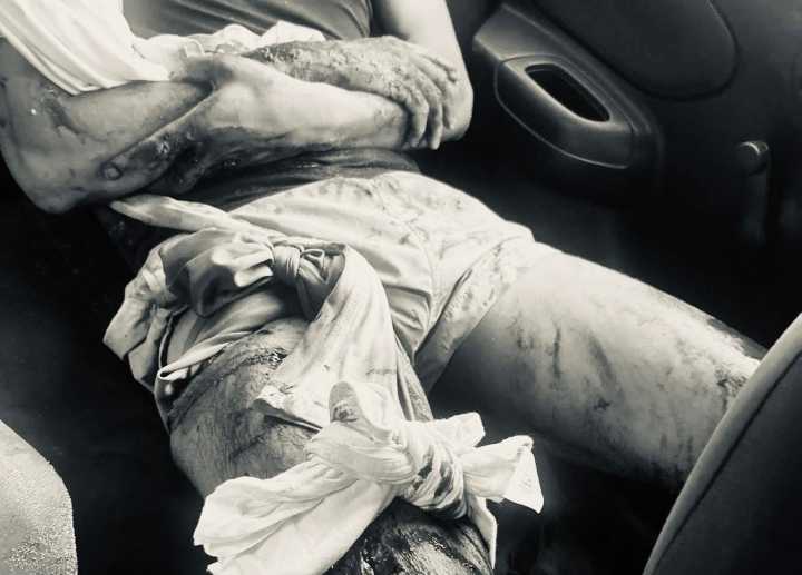 Cocodrilo ataca a dos turistas en playa Ventanilla, en la costa de Oaxaca; ambos están estables tras incidente